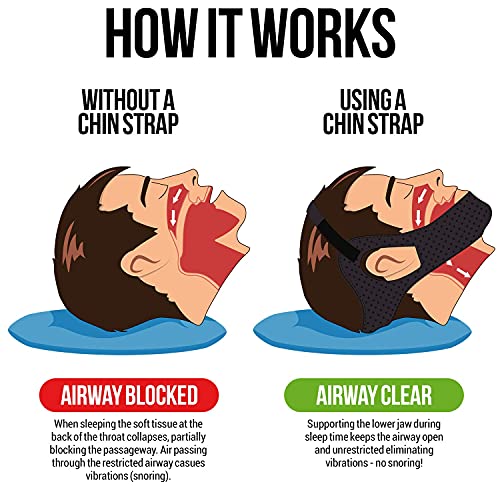 Anti Snoring Chin Strap, Large, Adjustable A9558