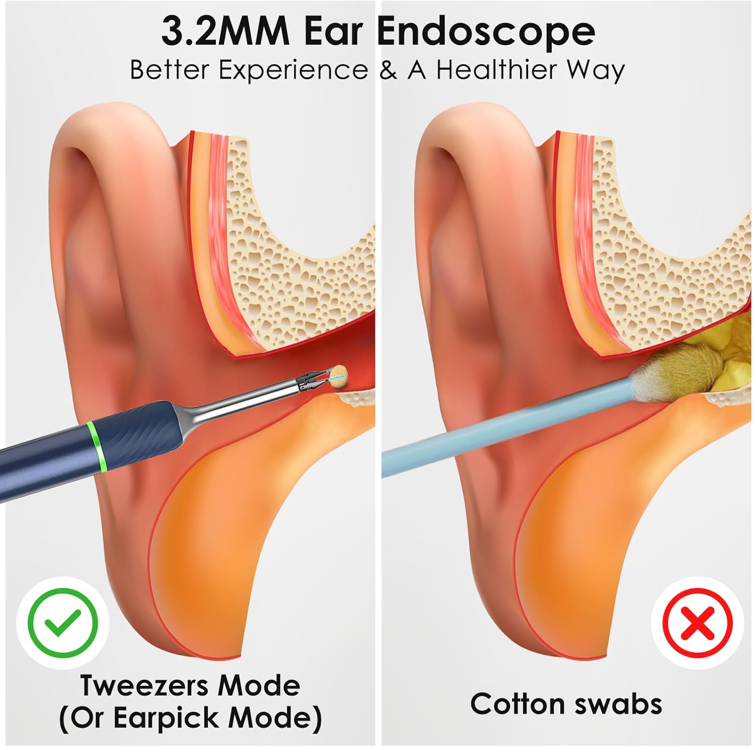 Ear Wax Removal Tool Camera with 10 Megapixels, 12 Ear Spoons, 2 Modes A846751