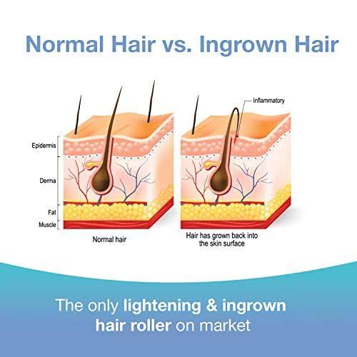 Dark Spot Remover Skin Care Treatment T8149